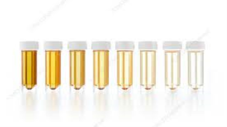 Urine Incontinence: How to Diagnose the Condition?