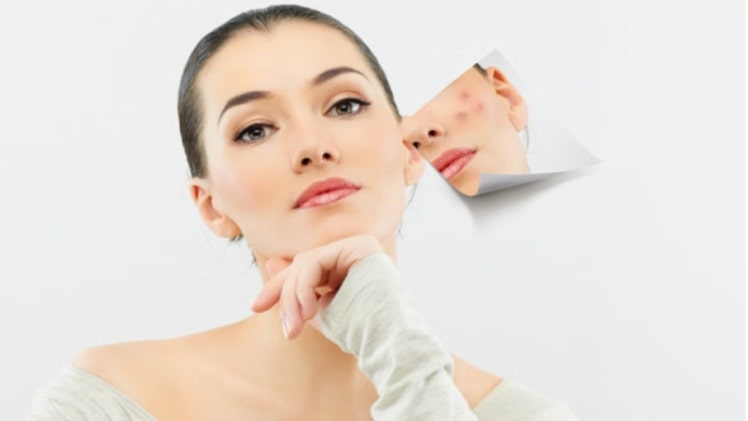 7 ways to take care of your face “sensitive skin”